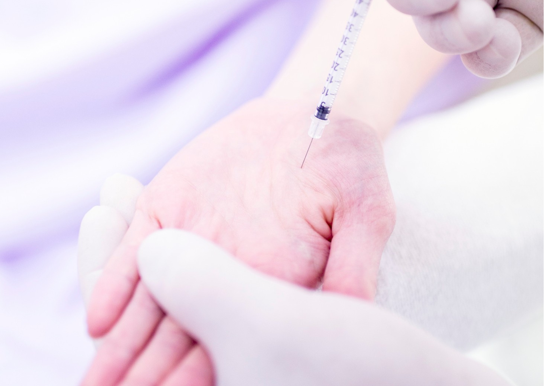 Treatment options for Sweaty Hands: Hyperhidrosis - KP Aesthetics
