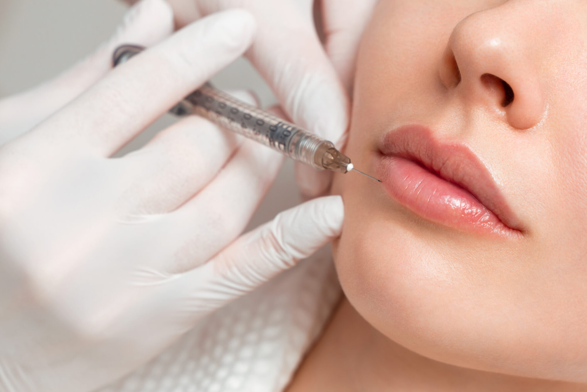 dissolving dermal fillers hale